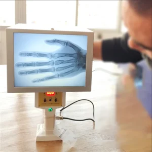 DYX-605 10-inch LED TV display portable x-ray inspection system Medical Fluoroscope Machine for veterinary hospitals