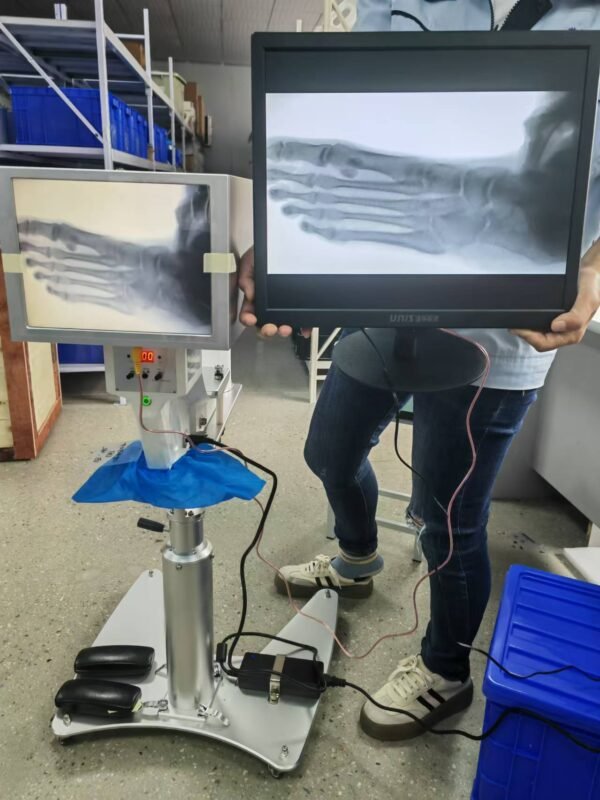 DYX-605 portable medical X-ray machine with stand for foot examination, foot disease and foot surgery