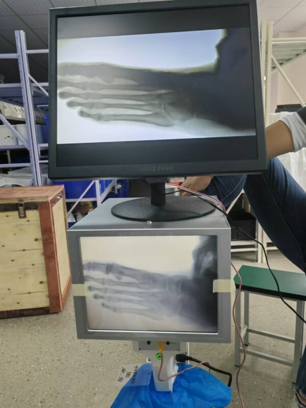DYX-605 portable medical X-ray machine with stand for foot examination, foot disease and foot surgery