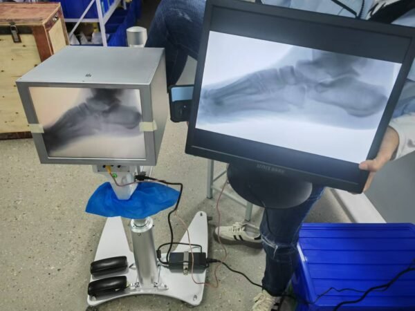 DYX-605 portable medical X-ray machine with stand for foot examination, foot disease and foot surgery