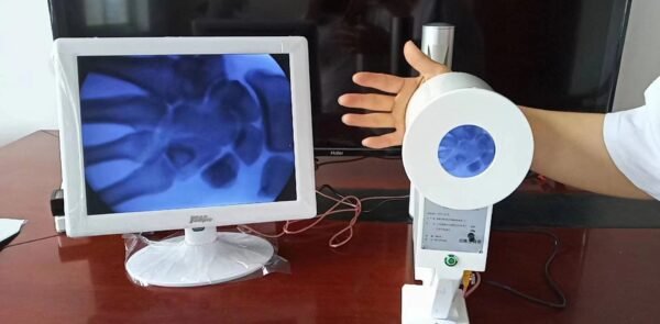 DYX-601 Cheapest low dose Portable Fluoroscopy X Ray Machine, Medcical Digital X-ray Radiology System Price