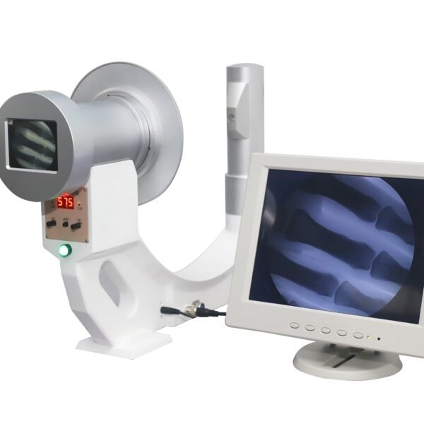 DYX-603Handheld fluoroscope machine portable x-ray Instrument smallest X ray diagnostic equipment price