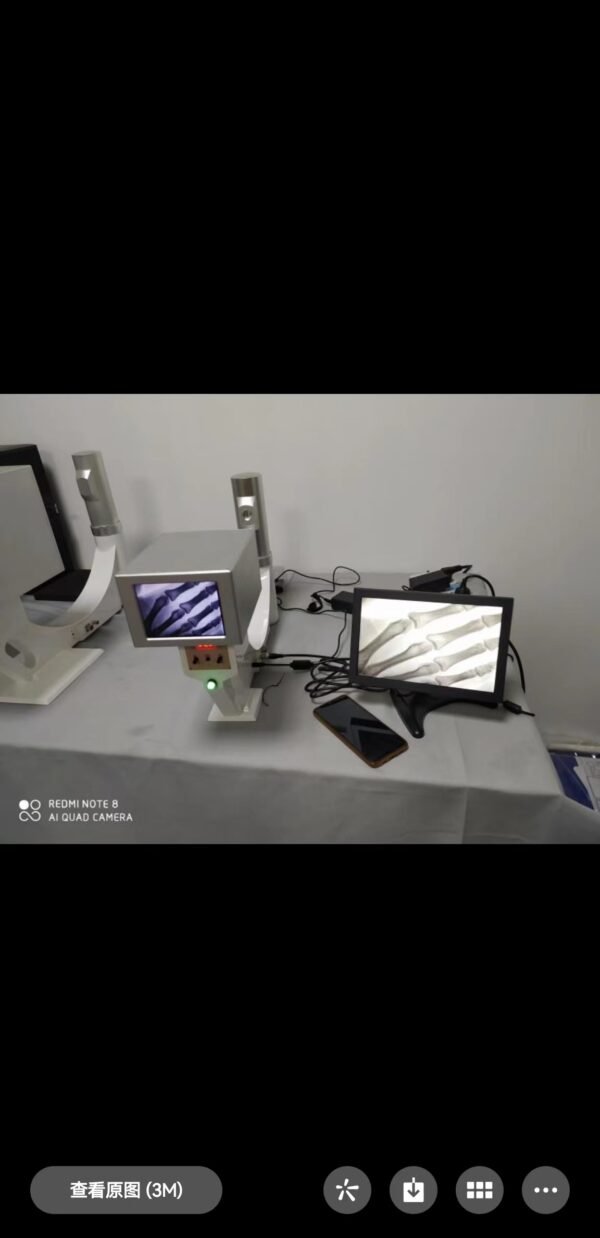 DYX-604 Battery powered High Safety Medical Portable X Ray Machine High Frequency Portable X-ray Equipment