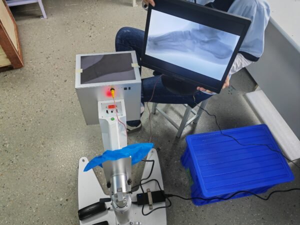 DYX-605 portable medical X-ray machine with stand for foot examination, foot disease and foot surgery
