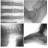 DYX-601 Cheapest low dose Portable Fluoroscopy X Ray Machine, Medcical Digital X-ray Radiology System Price