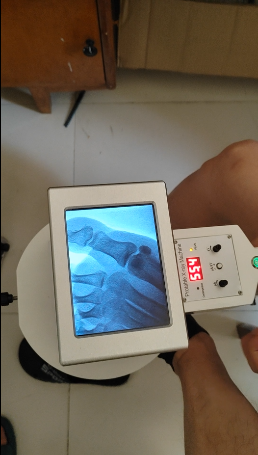 DYX-604 Medical fluoroscopio portable x-ray veterinaria xray system boej fluoroscopy x ray machine