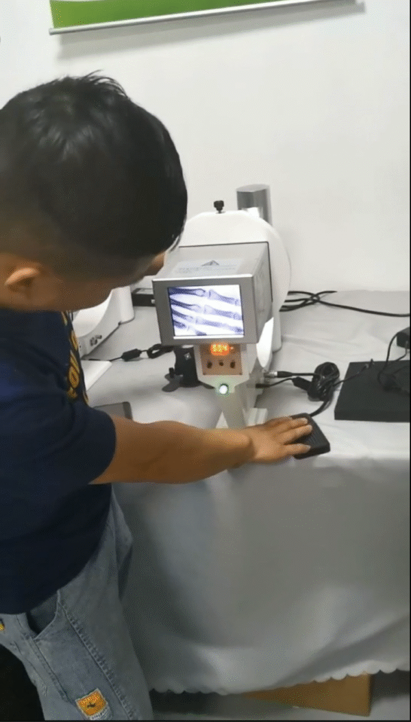 DYX-604 Medical fluoroscopio portable x-ray veterinaria xray system boej fluoroscopy x ray machine