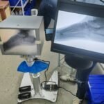 DYX-605 portable medical X-ray machine with stand for foot examination, foot disease and foot surgery