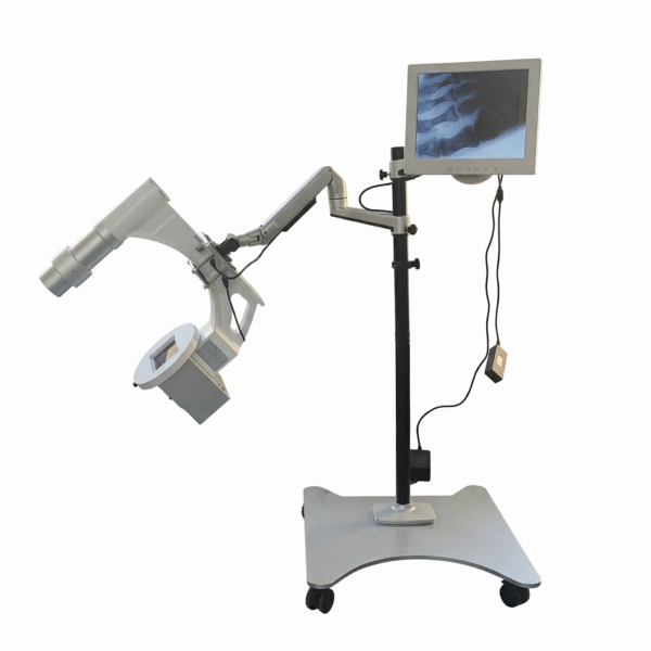 Gemini_Generated_Image_urw2y0urw2y0urw2 DYX-604 Mobile Wide-Field Fluoroscopy Station (Turnkey Clinic Solution)