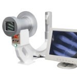 DYX-603 Portable X-Ray unit performing real-time fluoroscopy for clinical diagnostics