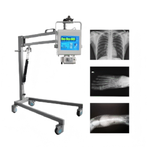 Buy portable DR x-ray machine , Wholesale 5kW portable x-ray , Portable digital radiography system price , Complete mobile DR system manufacturer.