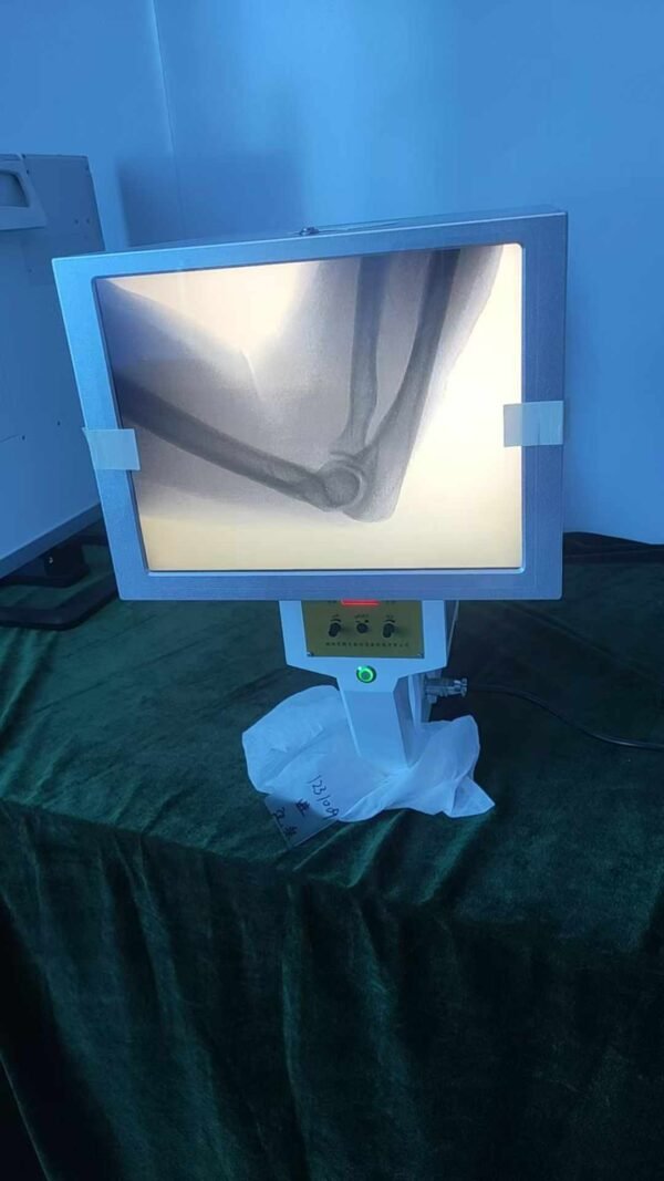DYX-605 Wide-Field Portable X-Ray Machine with High-Precision Imaging