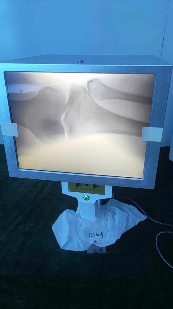 DYX-605 Wide-Field Portable X-Ray Machine with High-Precision Imaging