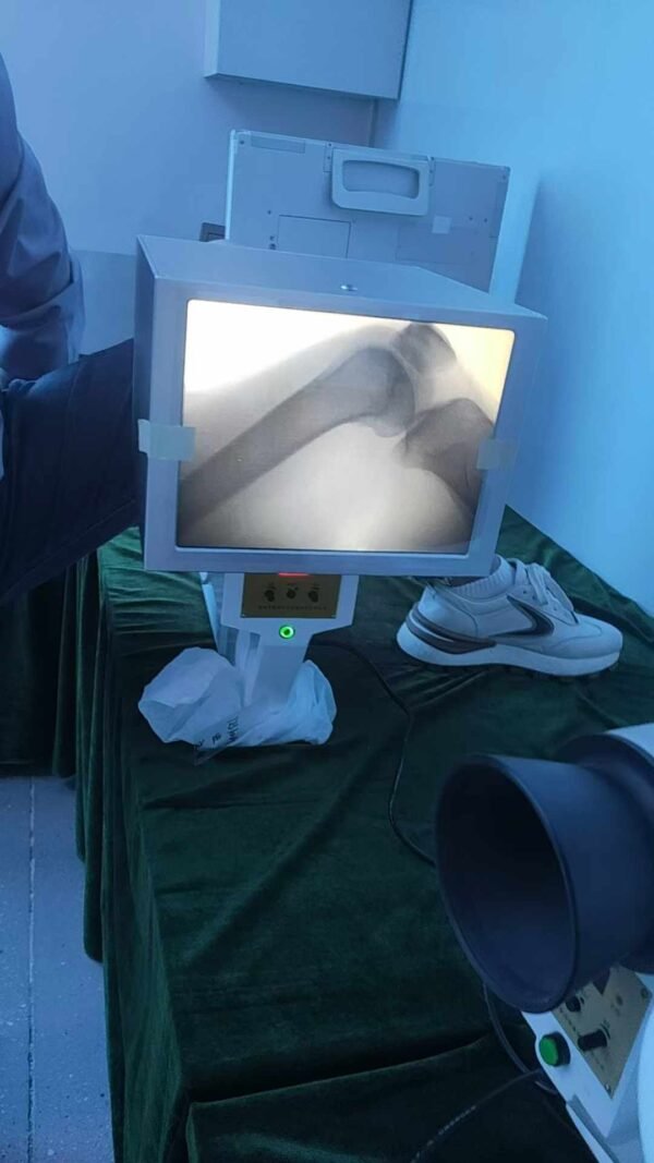 DYX-605 Wide-Field Portable X-Ray Machine with High-Precision Imaging
