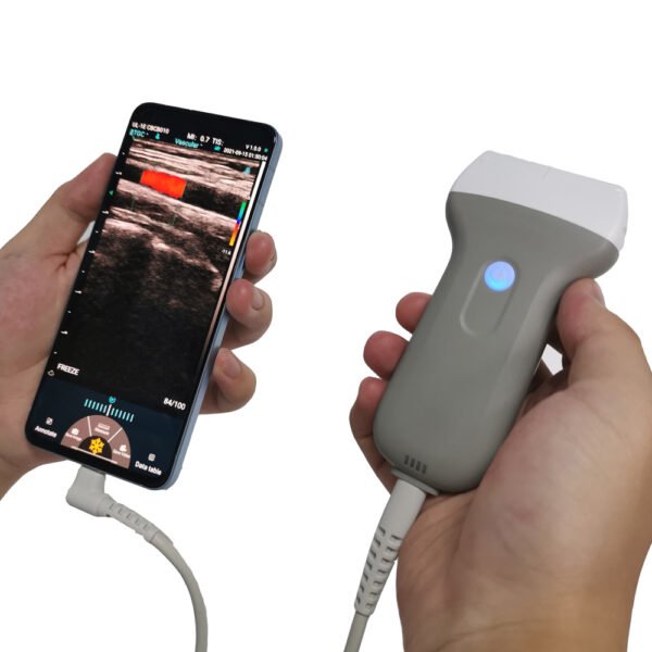 Handheld Color Doppler Ultrasound Probe | WiFi & USB | Convex & Linear Scanner