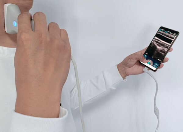 Handheld Color Doppler Ultrasound Probe | WiFi & USB | Convex & Linear Scanner
