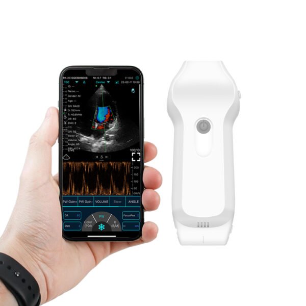 C10XL 正视 手机+手 Handheld Dual Probe Color Ultrasound C10XL | Linear & Phased Array | USB & WiFi